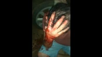 Reprodução/vídeo