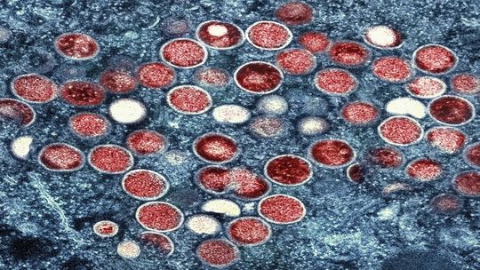 Partículas do vírus da mpox vistas em microscópio eletrônico. — Foto: NIAID via AP, File