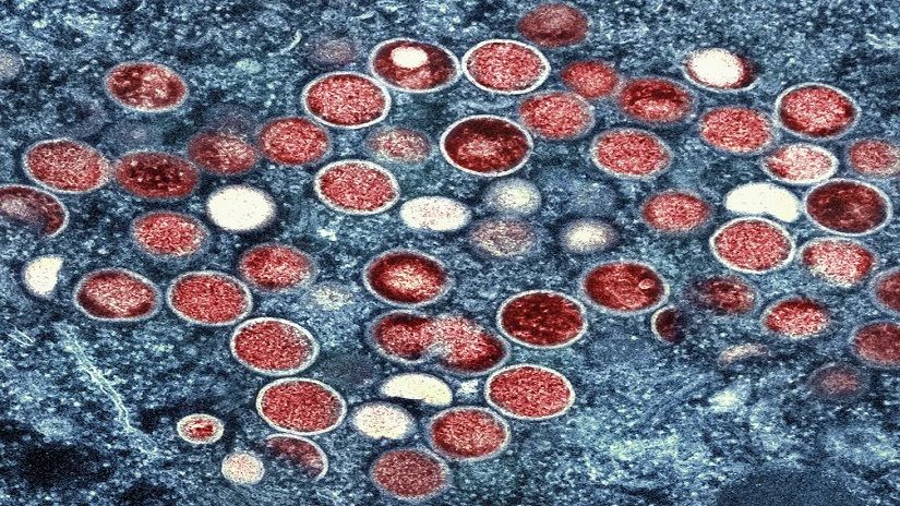 Partículas do vírus da mpox vistas em microscópio eletrônico. — Foto: NIAID via AP, File
