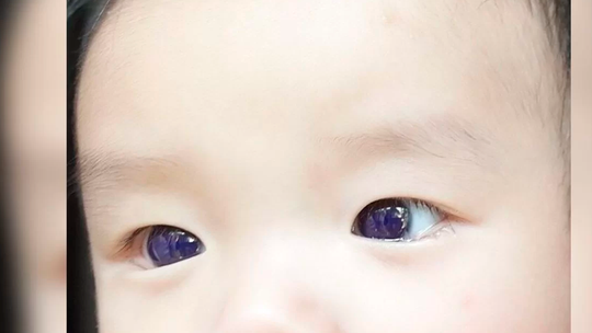 Revista: Frontiers in Pediatrics