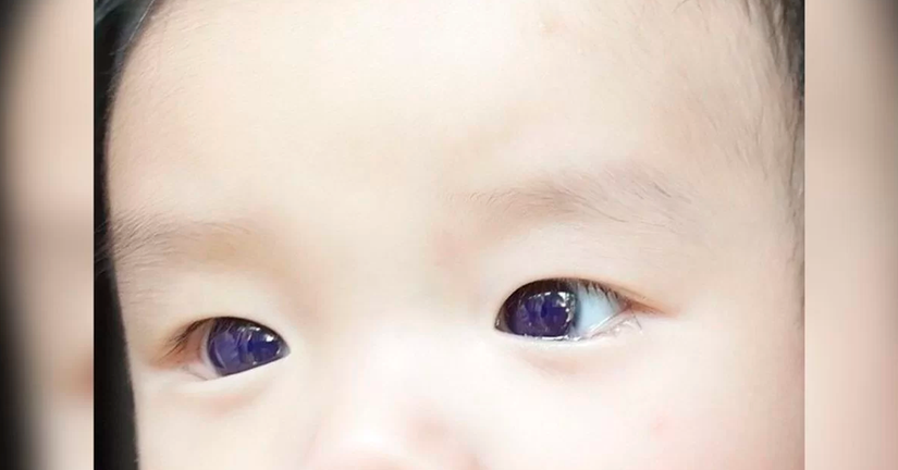 Revista: Frontiers in Pediatrics
