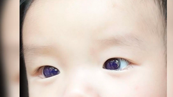 Revista: Frontiers in Pediatrics
